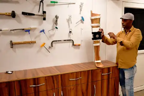Restoring Mobility: 300+ Artificial Limbs and Wheelchairs Distributed to Amputees
